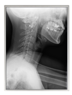 対角54cm(21.3型)アモルファスシリコンカラーTFT(薄膜トランジスタ)液晶ディスプレイモジュール「NL160120AM27-13A」